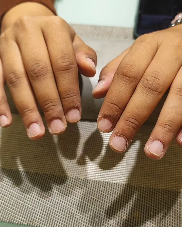 This is the 'before' shot of a client with short, bitten nails. This is the starting point for so many amazing transformations.