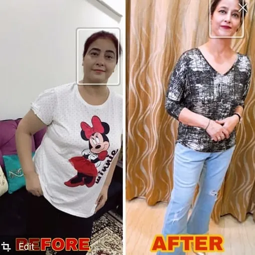 This is what happens when you stop making excuses and start practicing with me. Preeti lost a staggering 35 kgs, all while managing her hypothyroidism. We did this with no crash diets or pills, just one hour of my specialized yoga daily. Her transformation is proof that my method delivers guaranteed results.