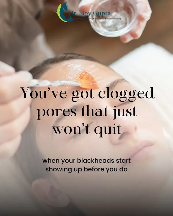 If you have clogged pores that just won't quit, it's a clear sign your skin needs professional attention. A medical facial can deeply cleanse and reset your skin in a way that at-home products cannot.