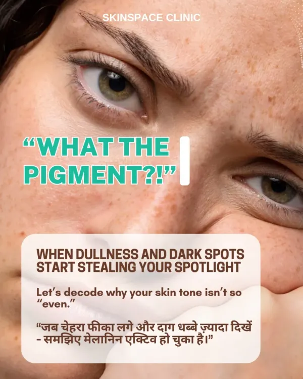 When dullness and dark spots appear, it's a sign of excess melanin activity. This graphic introduces the common problem of hyperpigmentation, which we are experts at diagnosing and treating.
