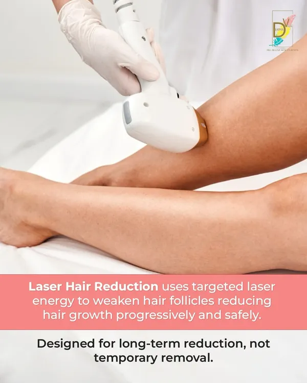 My Laser Hair Reduction treatment uses targeted laser energy to progressively and safely weaken hair follicles. It is designed for long-term reduction, providing a lasting solution beyond temporary removal methods.