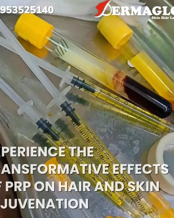 This is a close-up of the equipment used for a PRP facial. Your blood is drawn and placed in a centrifuge to separate the Platelet-Rich Plasma, which I then use for the treatment. This ensures the entire process is sterile and uses your body's own natural growth factors.