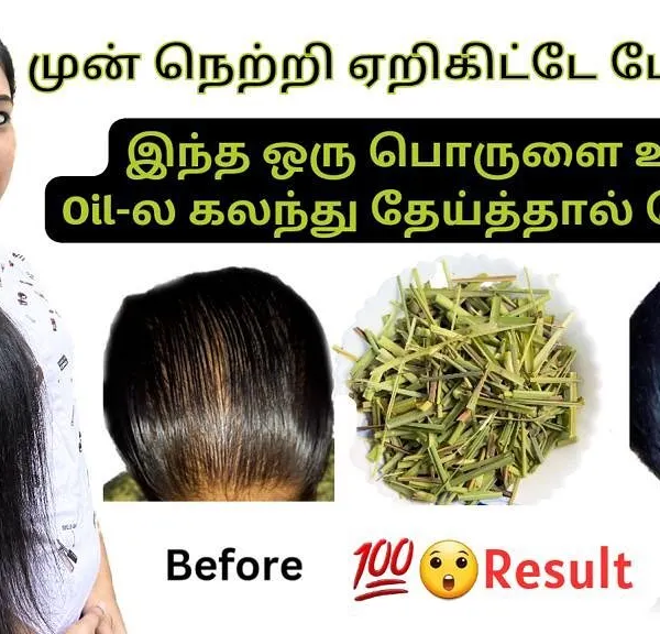 Are you worried about a receding hairline or thinning at the front? This is a very common concern, and I have a special natural remedy that I mix into my oil to help encourage new growth. The results can be truly wonderful.