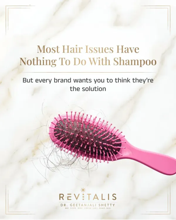 Brands want you to believe their shampoo is the solution to all your hair issues. *Sach bataun toh*, most problems like hair fall have nothing to do with your shampoo. They are often linked to internal factors like diet and hormones.