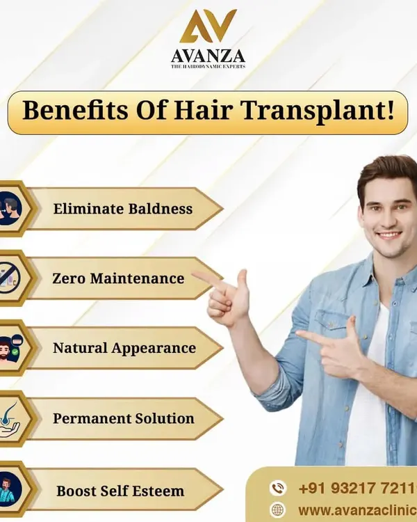 This graphic clearly lists the top benefits of a hair transplant. It is a permanent solution that eliminates baldness, requires zero maintenance once healed, provides a natural appearance, and delivers a major boost to self-esteem.