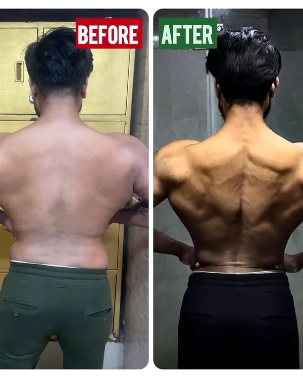 A clear example of body recomposition. We focused on strategic fat loss while retaining muscle mass, resulting in a defined and symmetrical back. This was achieved through a tailored calorie deficit and a training plan centered on progressive overload.