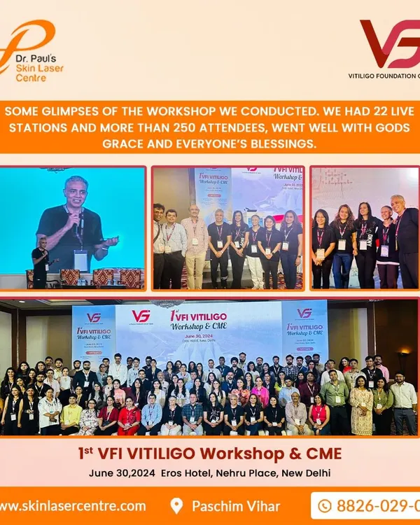 I was proud to conduct the 1st VFI Vitiligo Workshop, which included 22 live stations for over 250 attendees. Events like these are crucial for advancing our collective skills in treating vitiligo.