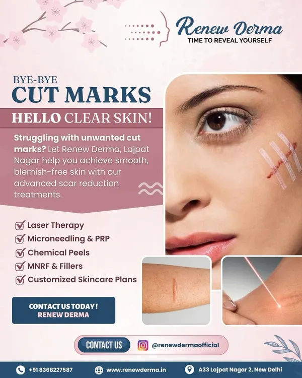 Say goodbye to cut marks and hello to clear skin. This graphic outlines our advanced scar reduction treatments, including Laser Therapy, Microneedling with PRP, Chemical Peels, and MNRF, all customized to help you achieve smooth, blemish-free skin.