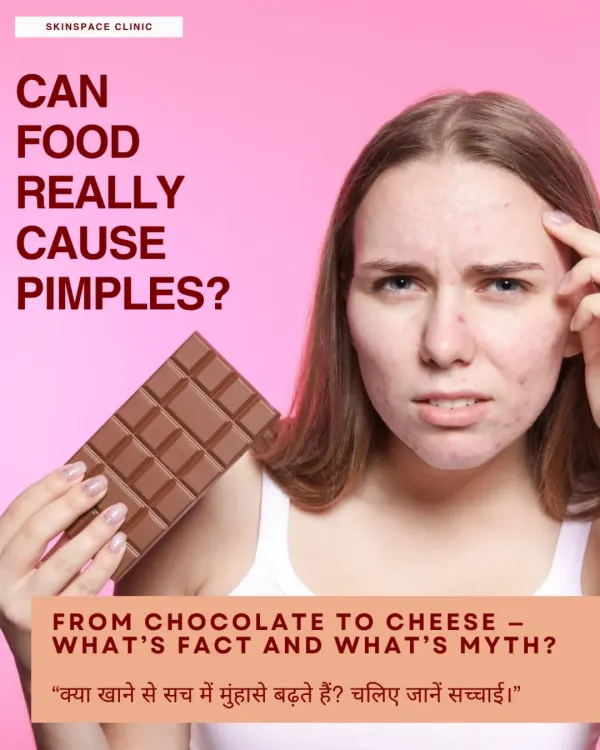A common question we get is whether food can really cause pimples. While diet isn't the only cause, certain foods can trigger breakouts in sensitive individuals. Let's separate fact from myth.