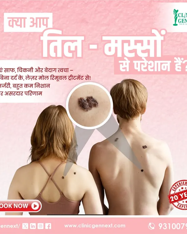 Many people are troubled by moles and warts, but trying home remedies can lead to scars and infections. I use an advanced laser procedure for removal, which is done without surgery or stitches, ensuring minimal to no scarring for clear, smooth skin.