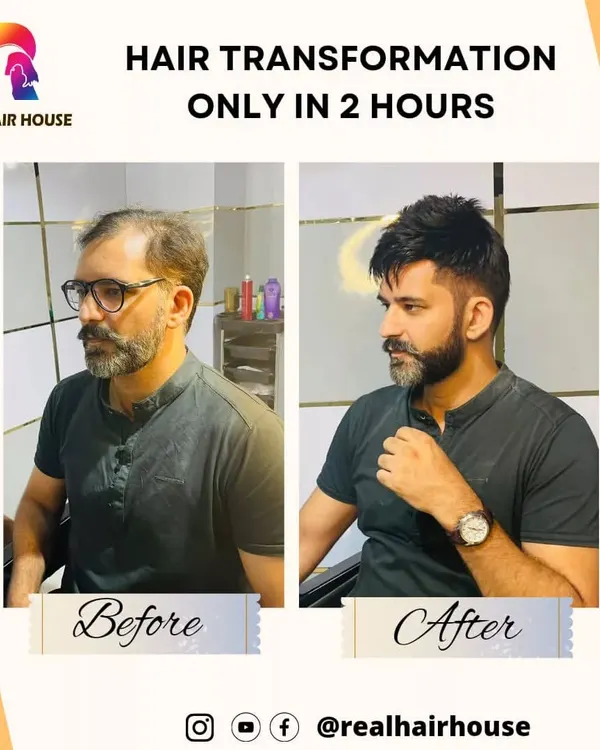 A stylish transformation for a modern look. I focus on cutting and blending the hair system to match your face shape and personal style, ensuring the final result is both natural and fashionable.