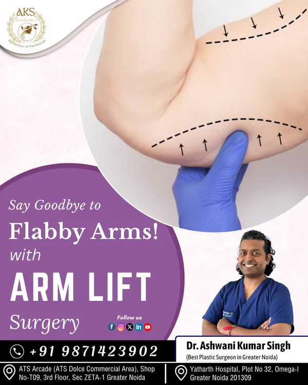 An arm lift is the definitive solution for "bat wings" or flabby arms caused by excess, sagging skin. The procedure creates a tighter, more toned appearance.
