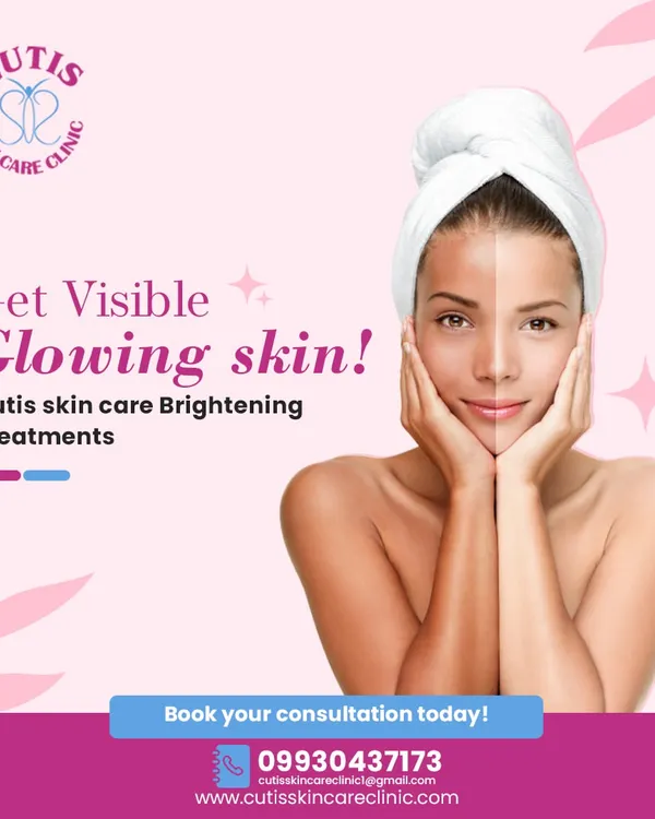 This before-and-after graphic demonstrates the visible results of my skin brightening treatments. I design these procedures to combat dullness and pigmentation, helping you achieve a significantly brighter and more glowing complexion.