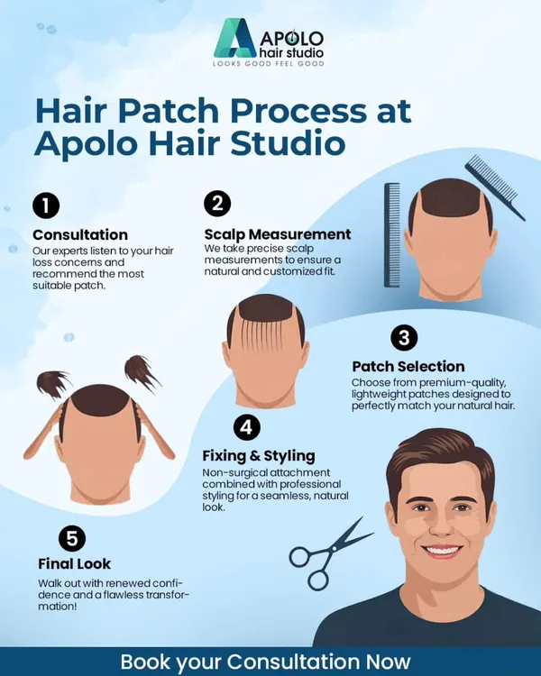 We believe in a clear and professional process. This infographic outlines our five steps to a flawless transformation, including consultation, scalp measurement, patch selection, fixing, and final styling.