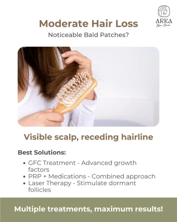 If you're noticing moderate hair loss, a visible scalp, or a receding hairline, we have solutions. Laser therapy is one of the best options to stimulate dormant follicles.