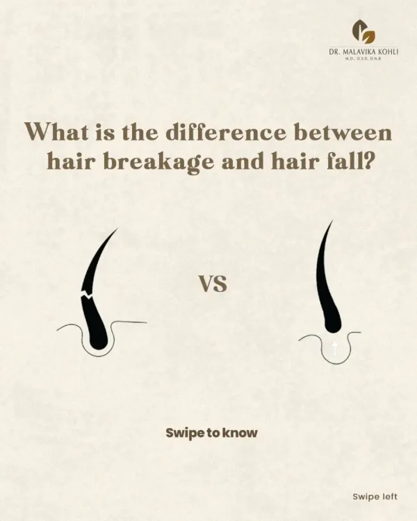 The initial step in any hair restoration journey is to determine whether you are experiencing hair fall or hair breakage. This simple visual illustrates the fundamental difference, which is crucial for developing an effective treatment strategy.
