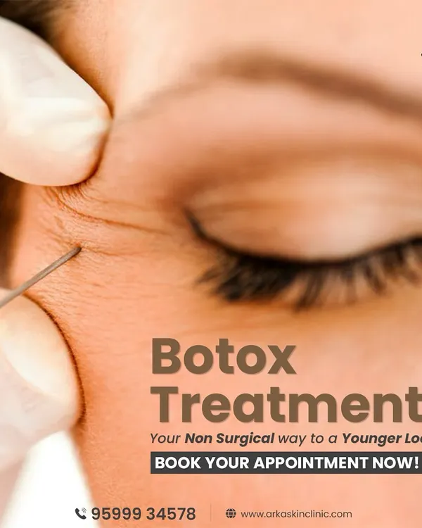 This is a close-up of a Botox treatment, a non-surgical way to achieve a younger look. It works by relaxing the muscles that cause expression lines, resulting in smoother skin. The procedure is quick, safe, and highly effective.