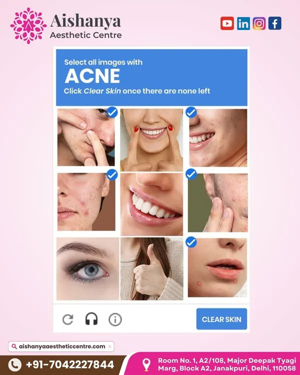 Tired of playing this game with your skin? You don't have to. I provide effective, science-backed treatments to clear acne for good, so you can feel confident in your skin every day.