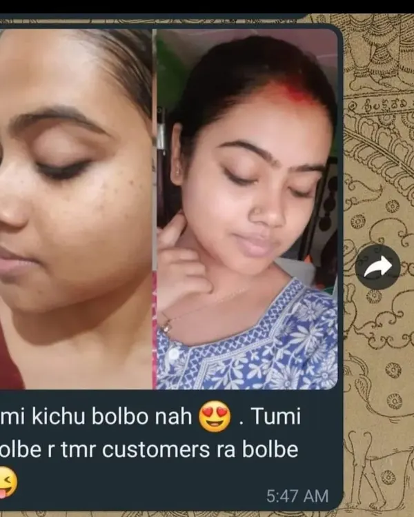 This before and after photo from a customer is the best review I could ask for. You can clearly see the improvement in her skin's clarity and glow. It makes all my hard work worthwhile.