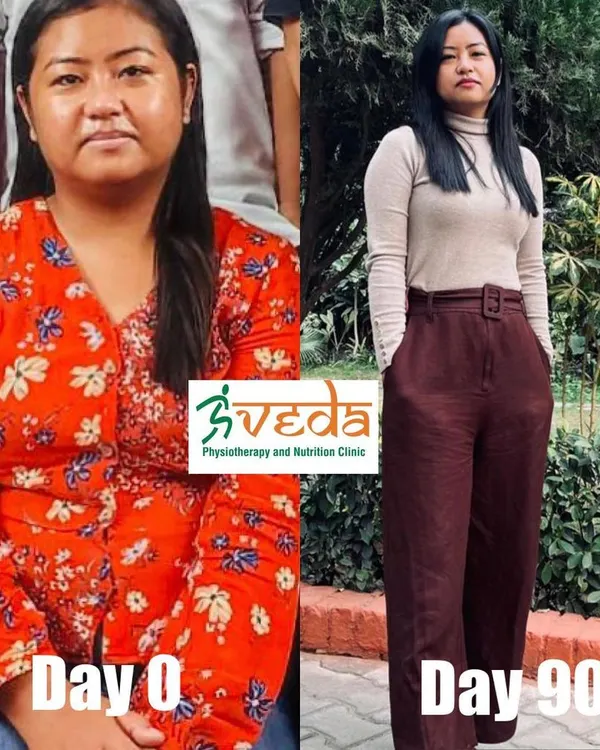 In just 90 days, this client lost 10kgs and resolved her stomach issues. Her transformation shows how well the body responds to a consistent, tailored diet plan, resulting in significant inch loss and improved well-being.