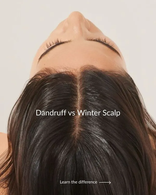 Before you reach for an anti-dandruff shampoo, let's determine what is really going on. This image introduces the common confusion between dandruff and a dry winter scalp, a distinction our trichologists are experts at diagnosing.