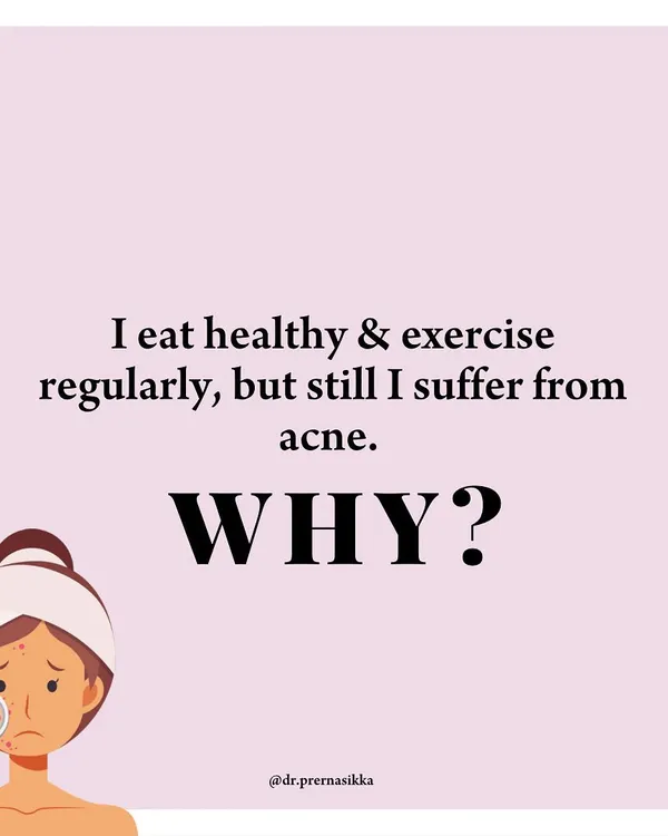 Do you eat healthy and exercise but still suffer from acne? In many cases, persistent acne is linked to internal hormonal imbalances like PCOS. I always recommend a full hormonal workup to identify the root cause and treat it early to avoid future marks and scars.