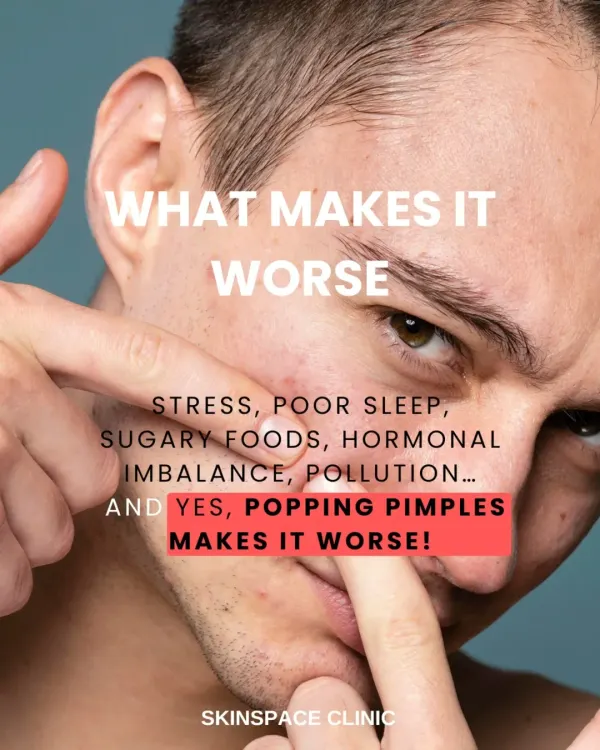 Popping pimples is one of the worst things you can do for your skin as it spreads bacteria and guarantees scarring. I work with patients to understand all their acne triggers, from stress and diet to hormonal imbalances, for a holistic treatment plan.