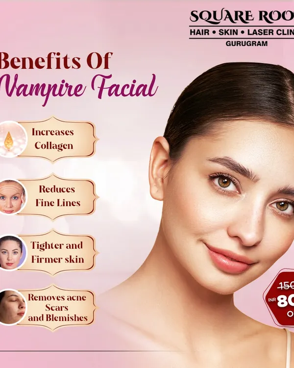 An overview of the benefits of a Vampire Facial, or PRP treatment. It increases collagen, reduces fine lines, tightens skin, and helps remove acne scars and blemishes.