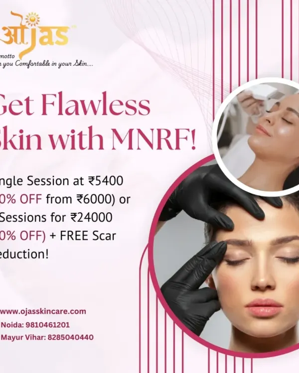 Achieve flawless skin with our MNRF treatment. This graphic details our special offer, including a single session discount or a package of 6 sessions with a free scar reduction treatment.