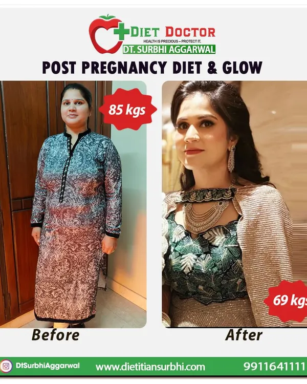 This before-and-after shows a 16 kg post-pregnancy weight loss, from 85 kgs to 69 kgs. The focus was on a balanced diet that supports healing and provides a natural, healthy glow.