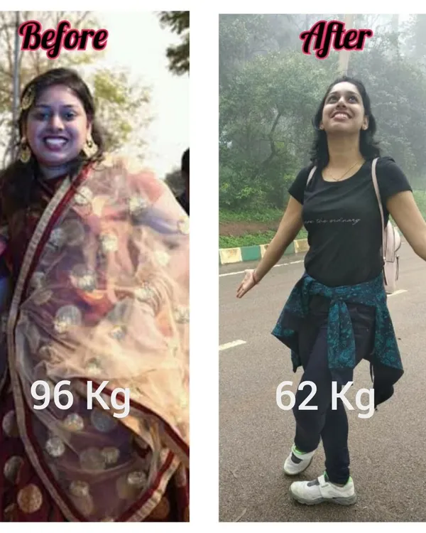 This is what real transformation looks like. Sarita went from 96 kg to 62 kg through pure consistency and discipline. This journey is not just about weight loss, it's about reclaiming your energy and confidence. Are you ready for your own transformation?