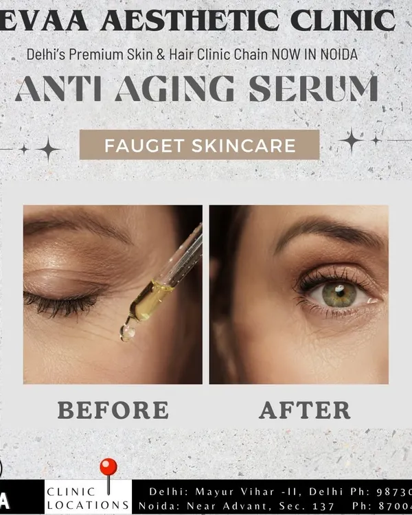 A before-and-after visual demonstrating the effectiveness of our anti-aging serums and treatments in reducing the appearance of fine lines around the eyes.