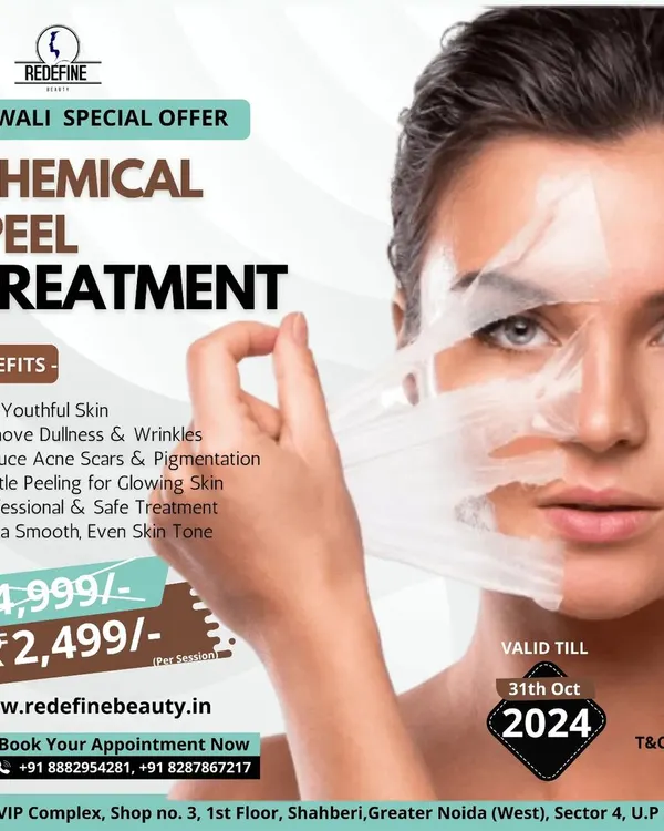 A Diwali special offer on our Chemical Peel Treatment. This is a professional and safe treatment to get youthful skin, remove dullness, reduce acne scars, and achieve a smooth, even skin tone.