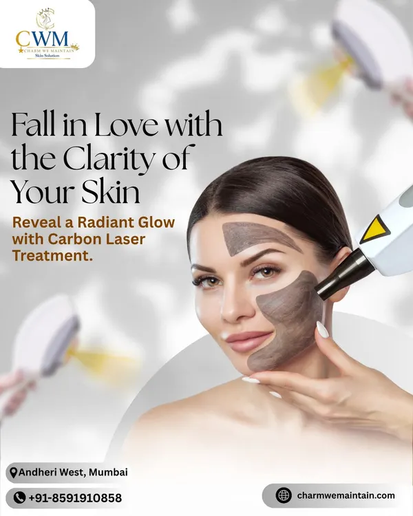 This graphic highlights the Carbon Laser Treatment, an excellent choice for revealing a radiant glow. It's a non-invasive procedure that helps improve skin clarity and texture.