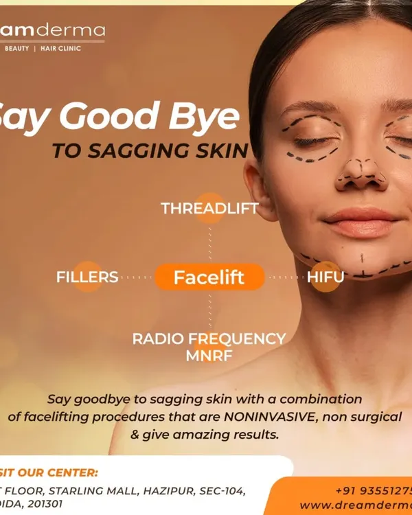 This visual guide shows the different non-invasive procedures I combine for a complete facelift effect, targeting sagging skin with treatments like Threadlift, Fillers, HIFU, and MNRF.