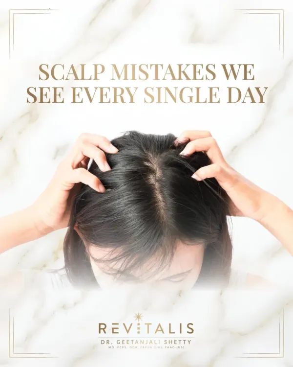 The foundation of my practice is focusing on the scalp. Before we can treat hair fall or dullness, we must address the health of the scalp where the hair grows. This is where I start with every patient.
