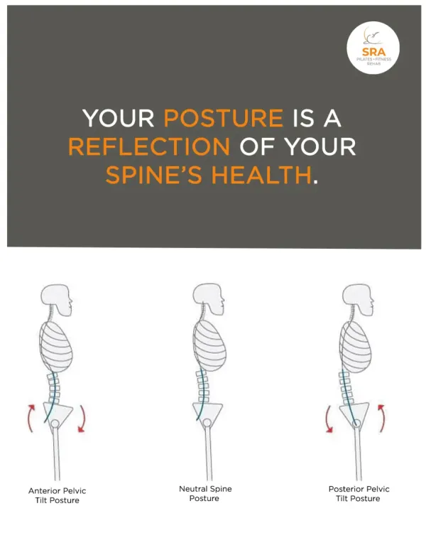 Your posture is a direct reflection of your spine's health. This graphic illustrates different pelvic tilts and their effect on posture. We work on finding a neutral spine to reduce strain and improve overall alignment.
