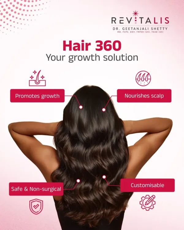 My Hair 360 treatment is a complete, non-surgical growth solution. It's a customizable plan that promotes new growth and nourishes the scalp from every angle, addressing the entire hair cycle for comprehensive results.