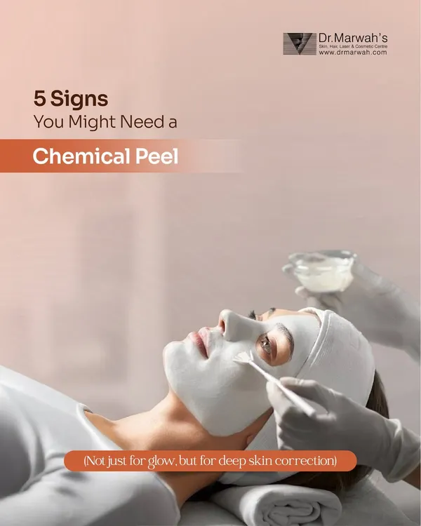 This image introduces the concept of chemical peels for deep skin correction, not just a temporary glow. A peel is a clinical procedure designed to address persistent skin concerns at their root.