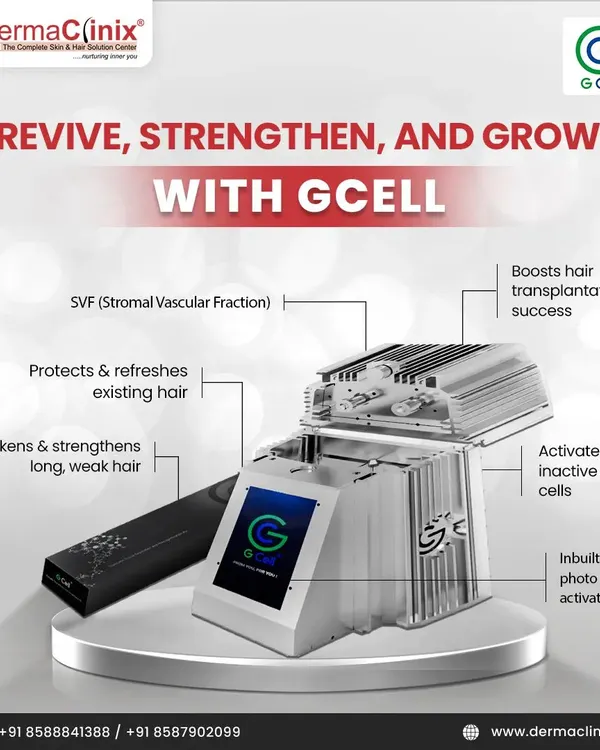 This detailed diagram explains how GCell technology works to revive, strengthen, and grow hair by activating inactive cells and even boosting hair transplantation success.