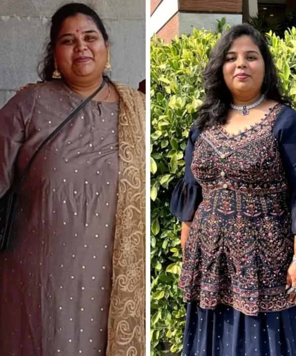 This is a before and after photo of my client Varsha, who was so dedicated. With a balanced diet plan and her hard work, she lost 20 kgs in just 6 months. It makes me so happy to see her transformation.