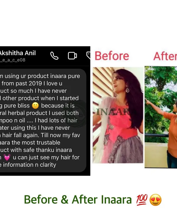 A journey from significant hair fall to healthy, thriving hair. This client has been using my Pure Bliss oil and shampoo since 2019, and her results speak for themselves. This is the power of sticking to a natural, chemical-free routine.