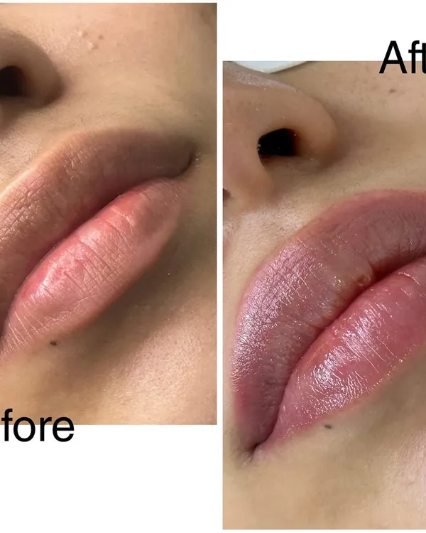 This shows how beautifully a lip blush heals after the first sitting. The color has softened into a subtle, natural tint that defines the lip border and adds a healthy glow.