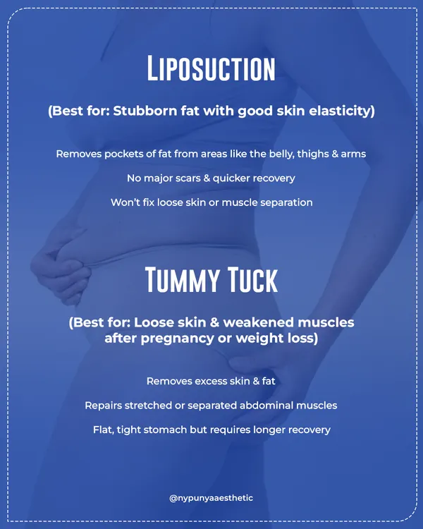 Here is a clear breakdown of when to choose liposuction versus a tummy tuck. Liposuction is ideal for stubborn fat with good skin elasticity, while a tummy tuck addresses loose skin and weakened muscles.