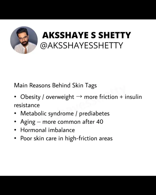 The main reasons behind skin tags are often related to metabolic health. Obesity, insulin resistance, metabolic syndrome, and hormonal imbalances are common underlying factors.