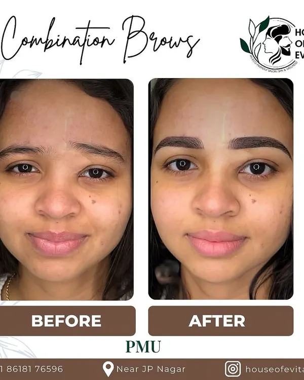 A stunning Combination Brow transformation. I gave her sparse, uneven brows a complete makeover with a defined arch and fuller shape, perfectly complementing her features.