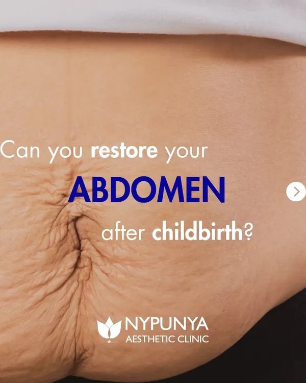 Can you restore your abdomen after childbirth? Yes. This series explains the changes that happen to your body and how body contouring treatments can help you regain confidence.