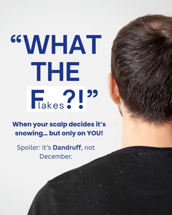 Seeing flakes on your shoulders? It's a common sign of dandruff, not just dry skin. We help you understand the real cause and provide effective treatments to get rid of it for good.