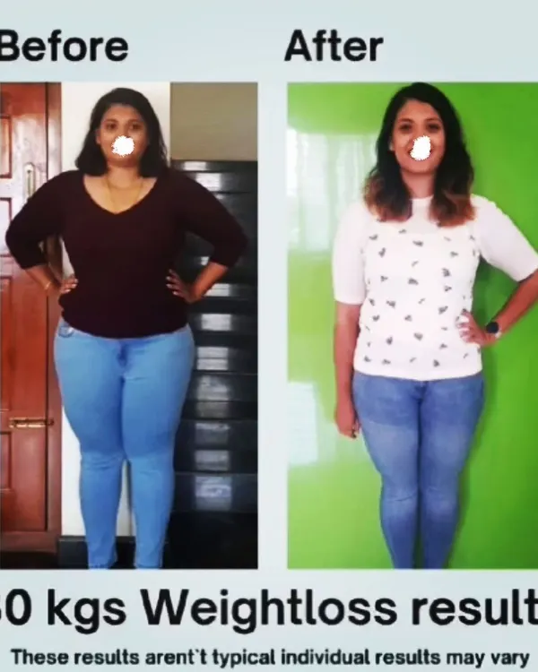 This is what a 30 kg weight loss transformation looks like. My client achieved this through consistent, small changes to her diet and lifestyle, not through a crash diet. This is proof that sustainable fat loss is possible with the right guidance.