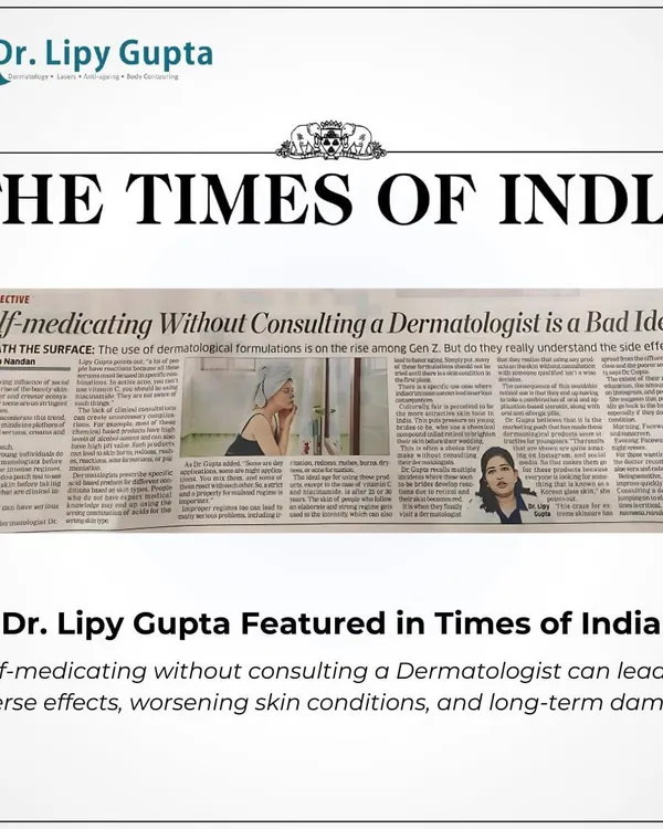 A snapshot of my featured article in the Times of India. I discussed the dangers of self-medicating with skincare and stressed the importance of seeking professional advice from a dermatologist for safe, long-term skin health.